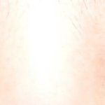 [댓글부탁해] 눈 사이 <b>거리</b> 먼거 앞트임하면 좁혀져??