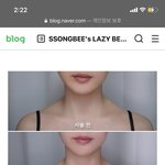 어깨 승모근 <b>시술</b>말고