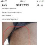 [19] 야 나처럼 이런거 있는 사람있어??