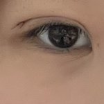 나 쌍수한지 하루 됐는데(사진<b>첨부</b>)