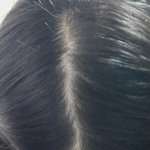 탈모<b>제품</b>1달쓰고 후기남길게 광고아님