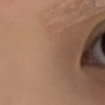 야 나 붓기 아직 <b>남아</b>있어보임??ㅠㅠㅠㅠ 제발