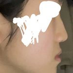 나 돌출입 개스트레스 받음