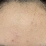 혐주의 내피부 _.됏.다. 인더모닝