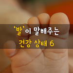 [50대] 발이 말해주는 건강 상태 6