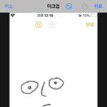 [댓글부탁해] 앞트임하면 바보되는거 아냐 ??