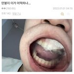 [드루와] <b>멍청</b>한애들보면 왤케 화가나지