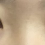 나 방금 <b>쌍수</b>하고 나왔는데 어때?