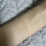 혐주의 하 이거 금속<b>알러</b>지냐