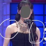 [19] 이 팔뚝살 <b>명칭</b> 뭐여&amp;어케 뺄수있음?