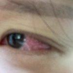 나 좀비<b>바이러스</b>에 감염됐어