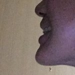 <b>네모</b>주걱턱 사각턱 성형