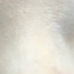 쌍수하고싶은데 어떻게생각해