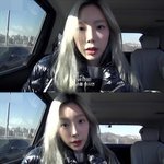 최근 태연한테 살짝 생겼다는 알레르기