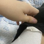 [ㅈㄱㄴ] 일용직으로 택배일함 후기,멍듬 ㅇㅇ