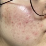 나 피부 좋아진 것 좀 봐 +추천템있음