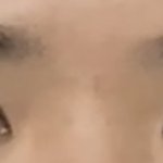 쌍수하고 나니까 눈이랑 눈썹사이가 넘 가까워졌어