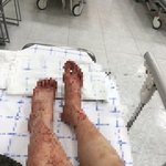 [댓글부탁해] 데이트폭력 <b>특수</b>협박 생존자이자 피해자입니다.