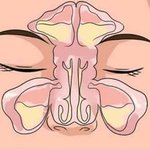 [이것좀봐줘] 완전 개꿀팁 막힌 코 뚫는 법이래