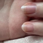 [댓글부탁해] 나 <b>손톱</b> 왜이럼???
