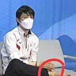 <b>하뉴</b> 발목 봤어?ㅠㅠ