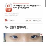 <b>판</b> <b>레전드</b> 쌍수