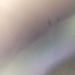 [댓글부탁해] 다래끼 굳으면 <b>무슨</b> <b>느낌</b>이야??