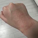 찬바람 알레르기 있는 사람 있니?