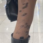 제2의 스타킹 먹물 <b>테러</b> 사건 발생
