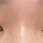 이런 코는 <b>쉐딩</b> 어떻게 해야함?