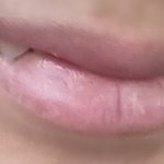 웃을때 <b>덧니</b> 조카 스페셜해~^~^