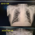 "나 가망 없다 그러지?"  대학병원 중환자실 자리없나요ㅠ?