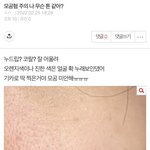 나 무슨 톤 같아? 모공혐 주의! <b>고어</b>짤아니야 진짜로ㅠㅠ