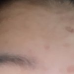 [댓글부탁해] 오래된 <b>색소</b>침착 어떻게 없애ㅠㅠ