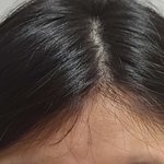 [댓글부탁] 나 <b>이마</b> 좁은편이지?