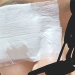 [드루와] 나 왕<b>다래끼</b> 났던사람인데