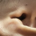나 귀에 블랙<b>헤드</b>임…?