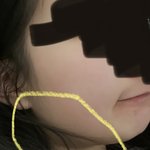 [댓글부탁해] 나 말랐는데 <b>턱살</b>이 왜 있는 걸까