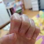 나 <b>손톱</b> 뜯는 버릇 드디어 고쳤다ㅠ