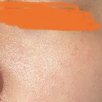 오늘 나 피부 컨디션 <b>미침</b>