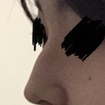 [댓글부탁해] 매<b>부리</b>코 수술 할건데