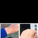 [이것좀봐줘] 여시 언냐들과 제 손과 <b>손목</b> 비교 ㅋㅋㅋㅋㅋㅋㅋ