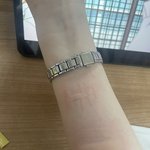 [드루와] 혐주의)이거 피부묘<b>기증</b>임?