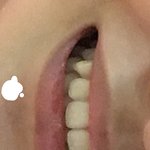 [댓글부탁해] 제발 제 <b>이빨</b>좀 봐주세요~~~