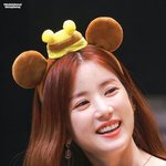 웃을 때마다 차오르는 눈 밑 애<b>교살</b>