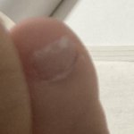 [댓글부탁해] 나 새끼발가락 <b>발톱</b>이 거의 없어