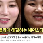[댓글부탁해] 이거 <b>앞광대</b> 아님? 왜 옆<b>광대</b>임?