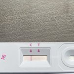 자가<b>키트</b> 이정도면 pcr 무료임?