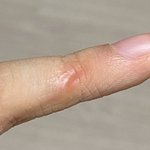 새끠손가락 <b>이지랄</b>로피테쿠스됨
