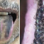 혓바닥에 털 난 사람...인구의 13%서 <b>발생</b>